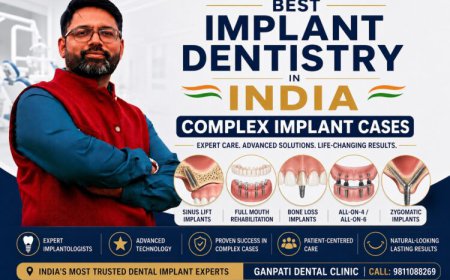 Best Implant Dentistry in India: Complex Implant Cases